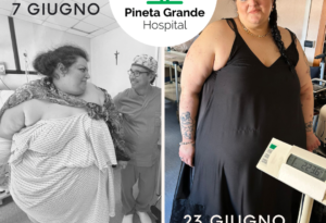 MONICA, DA 287 A 223 KG IN DUE SETTIMANE, AL PINETA GRANDE HOSPITAL RIPRENDE IN MANO LA SUA VITA